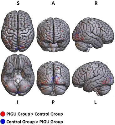 Cue-Reactivity Among Young Adults With Problematic Instagram Use in Response to Instagram-Themed Risky Behavior Cues: A Pilot fMRI Study